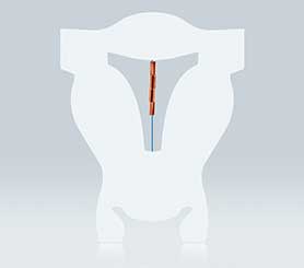 Kupferkette Gynefix Menstruationstasse